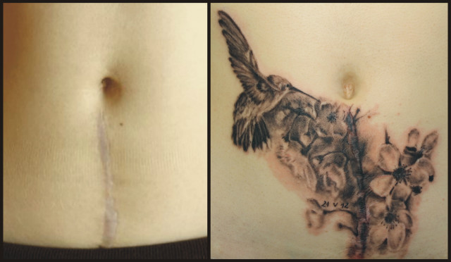 tatua na blinie...