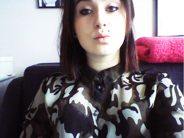 black eyes