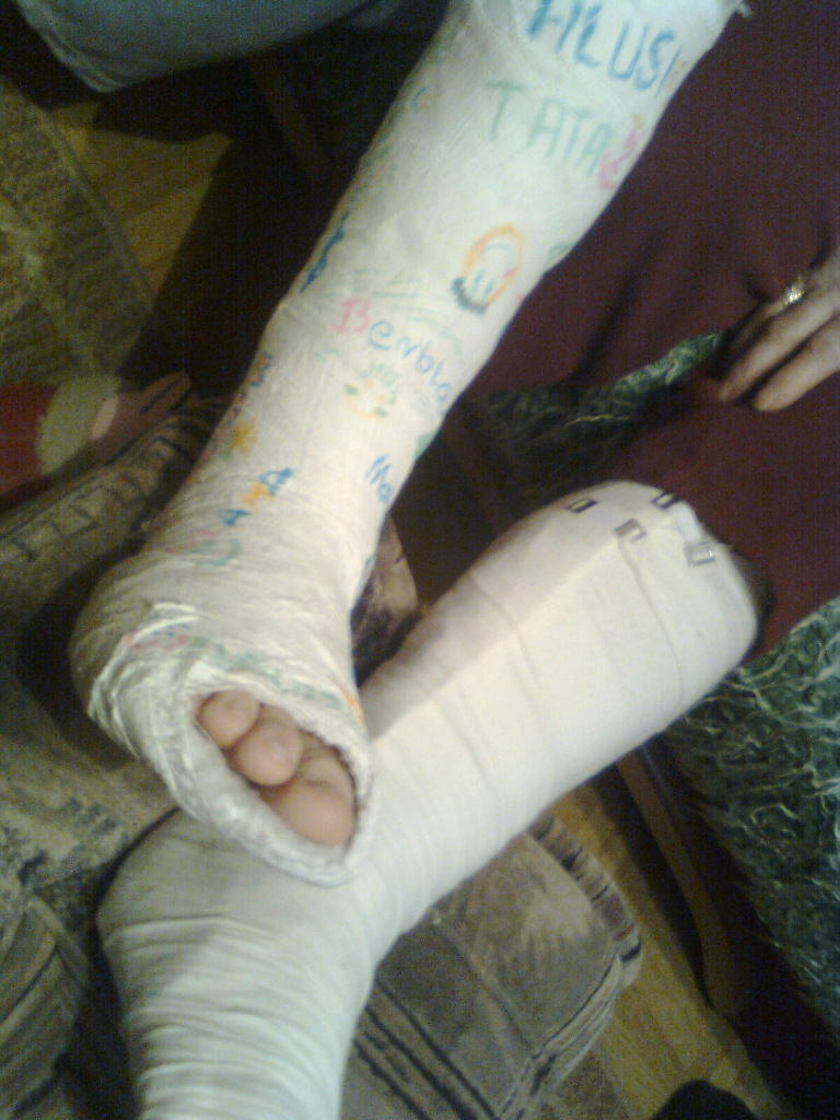 Gips :3