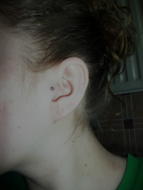 2. Tragus