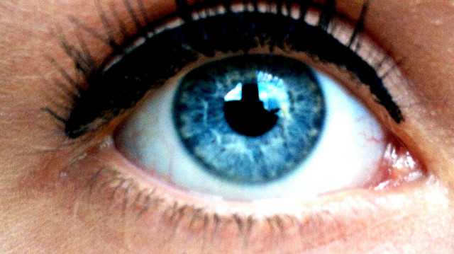 my eye 