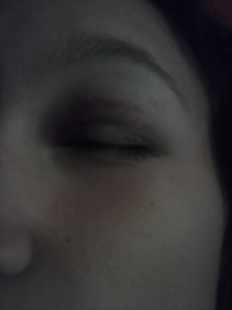 #eye.