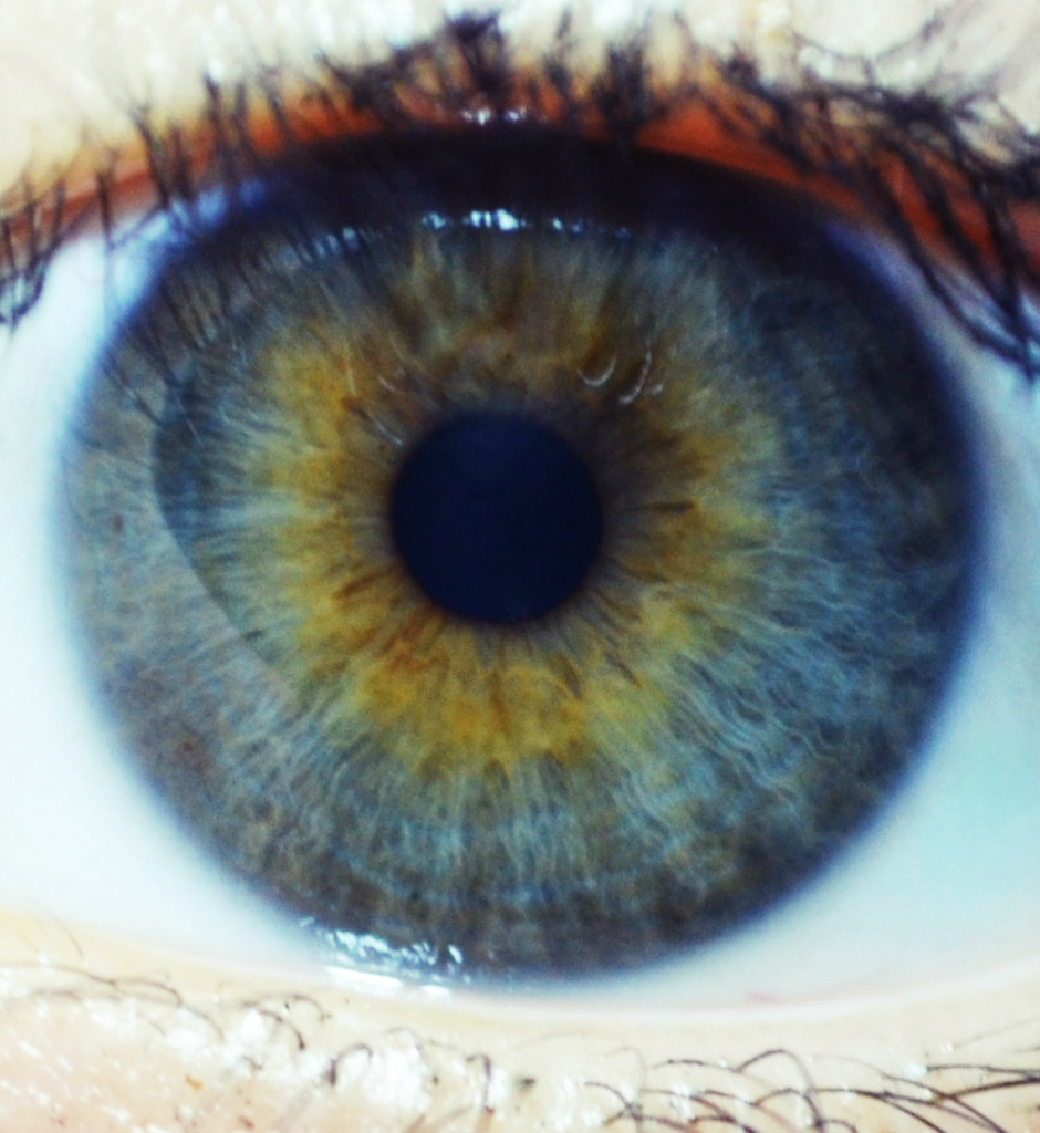Eye