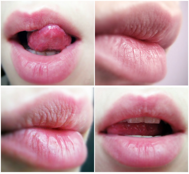 Lips