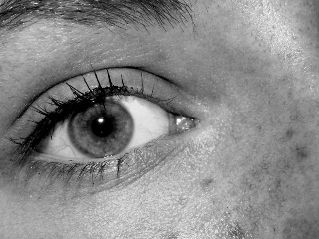 ugly eye
