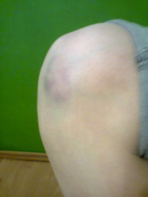 Lodooo ;DD 