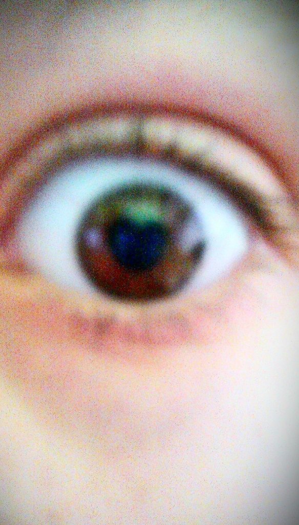 Oczkoo;**
