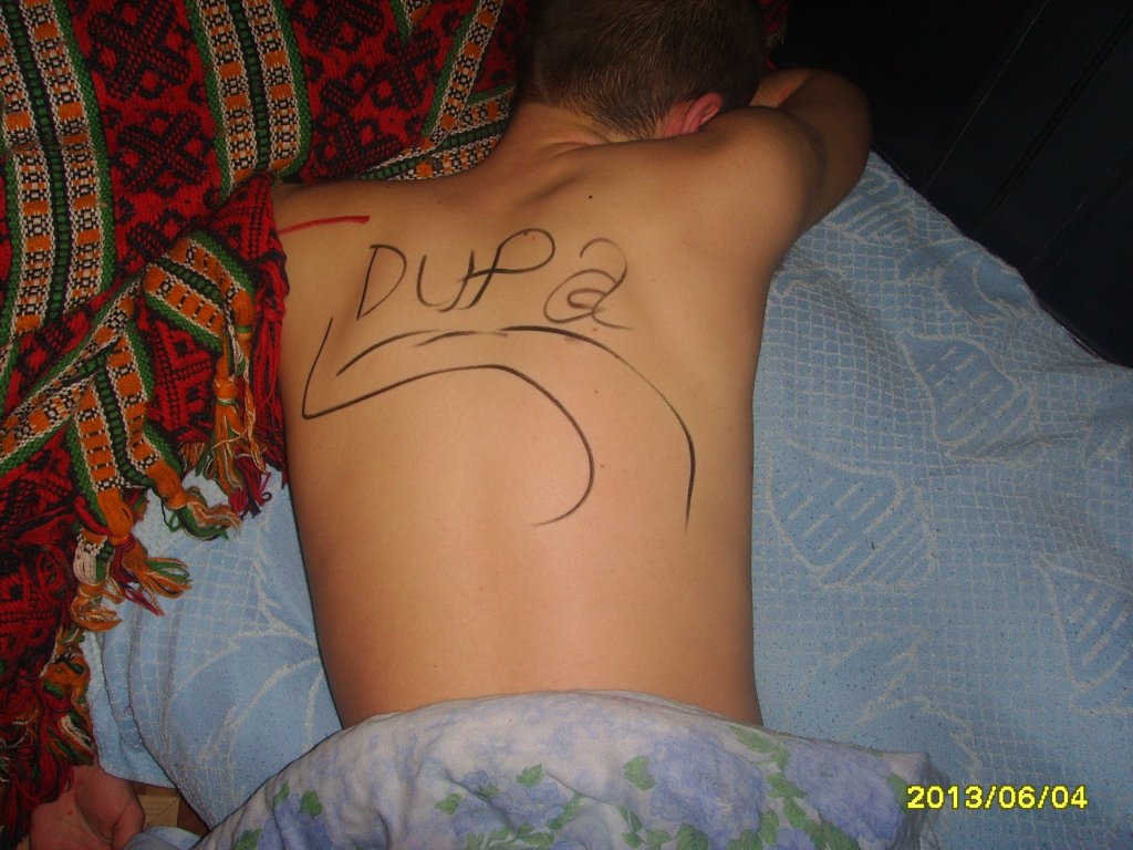 DUPA