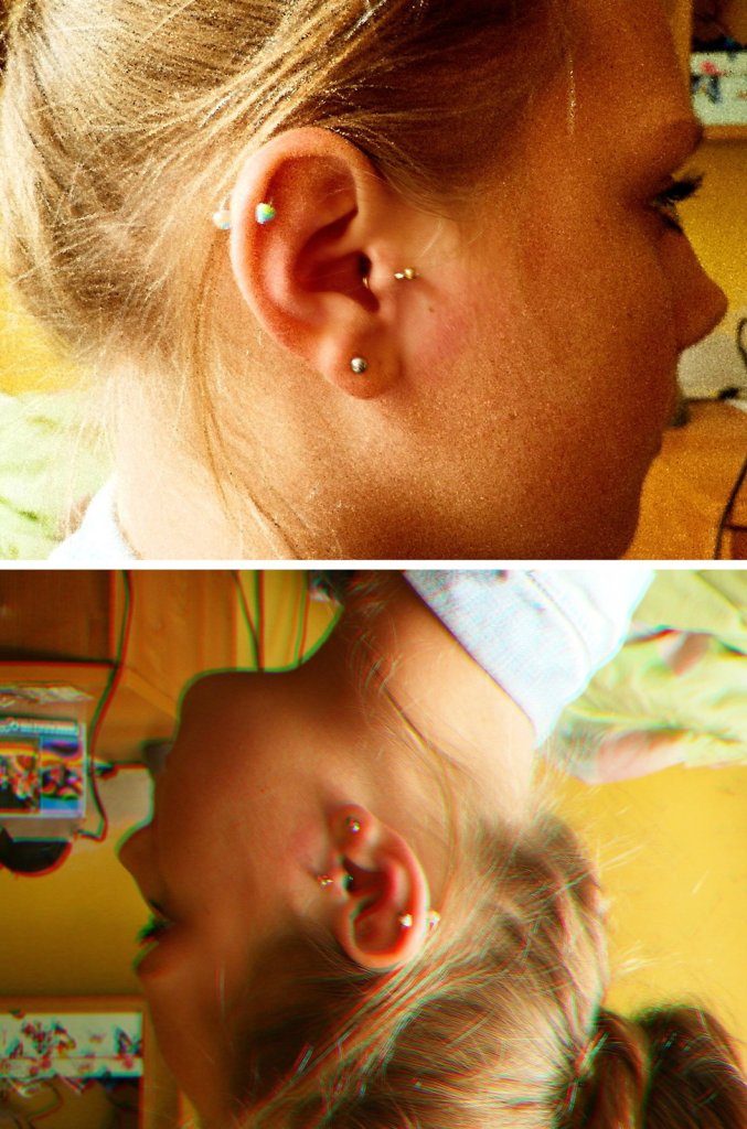 05. Tragus