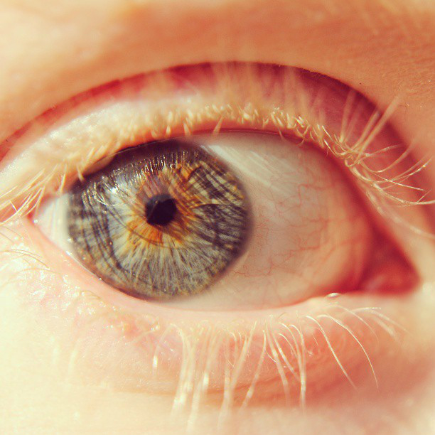 eye