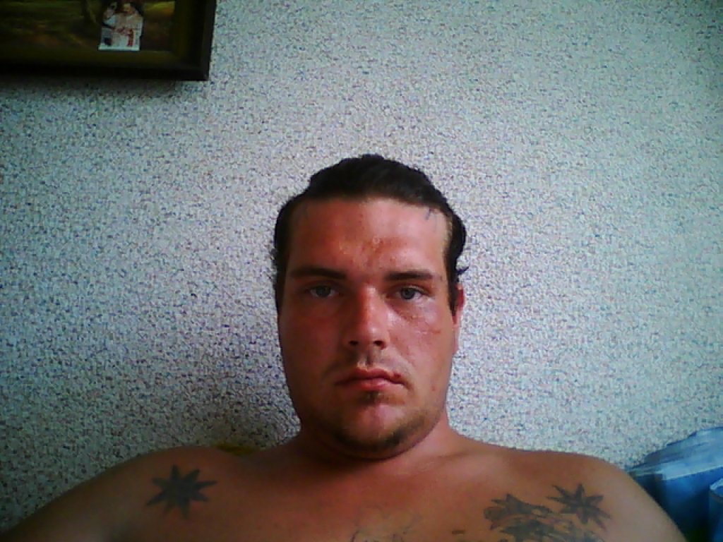 Diabe