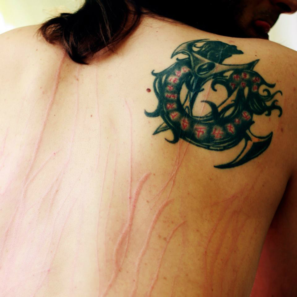 Scars are memories