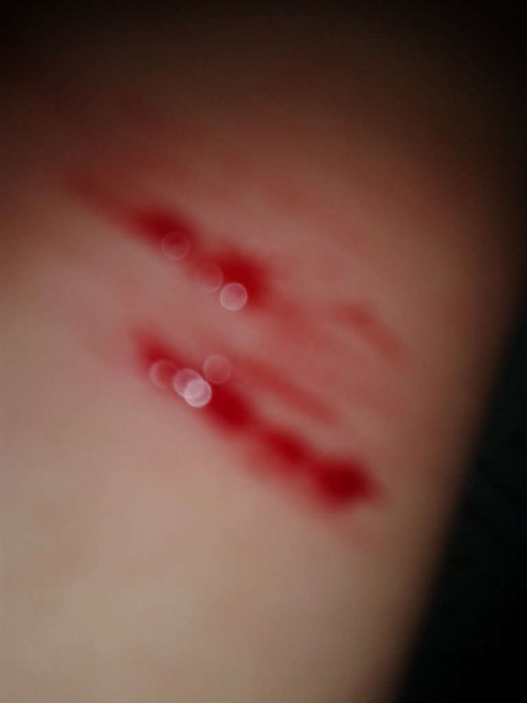 i dupa