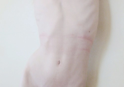 i'll die if you touch me