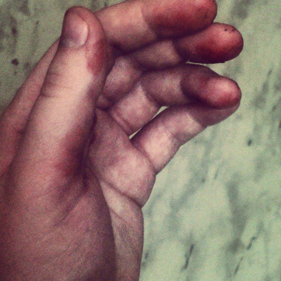 Blood.