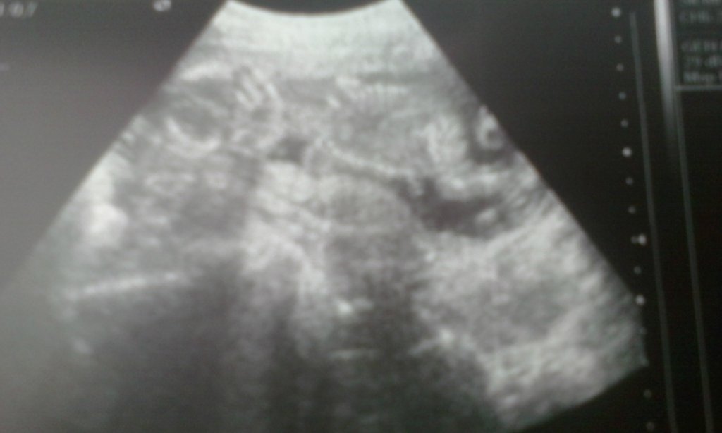 Malestwo . < 3 . 