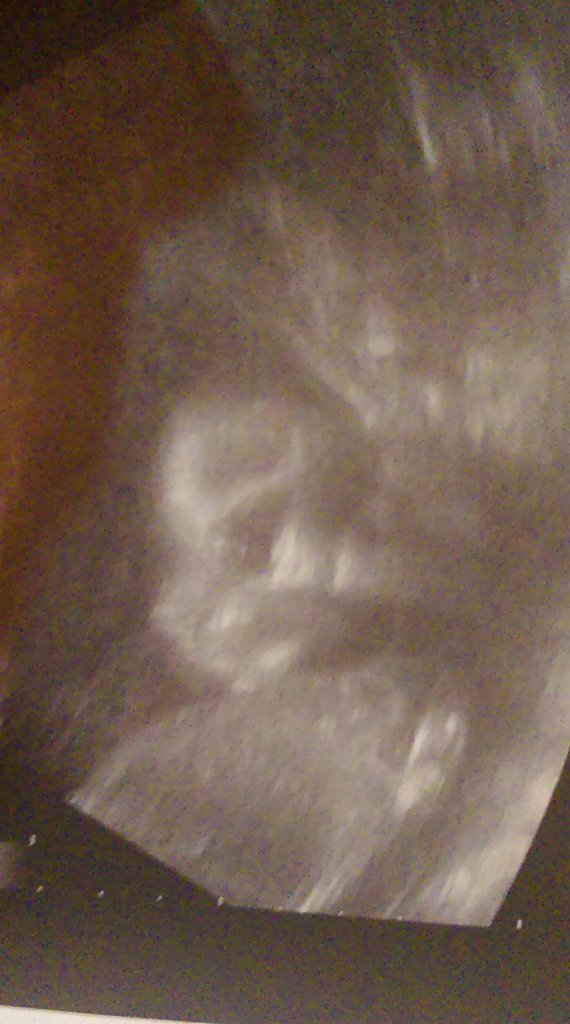 moja