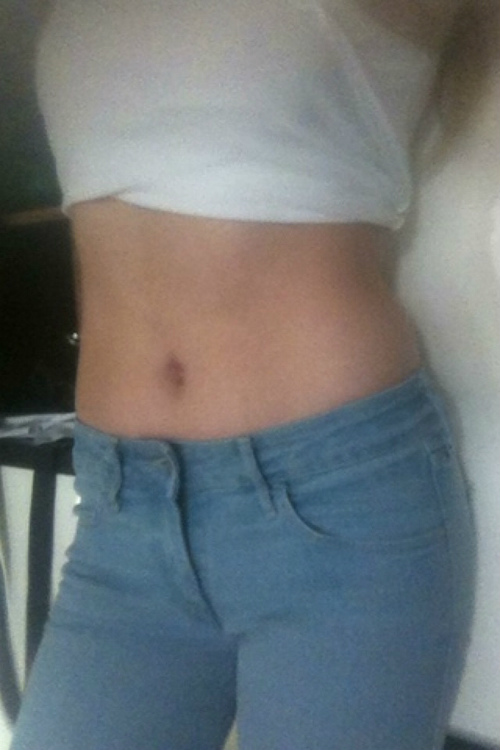 stomach 