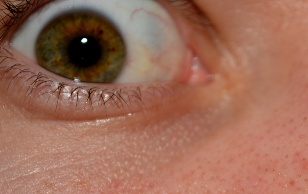 eye