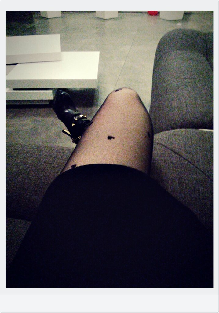 legs