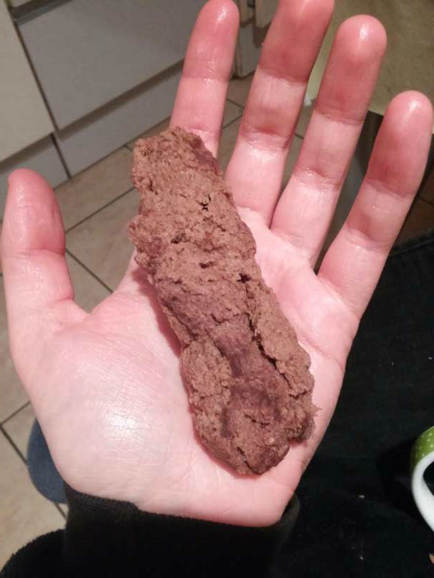 Fecal matter