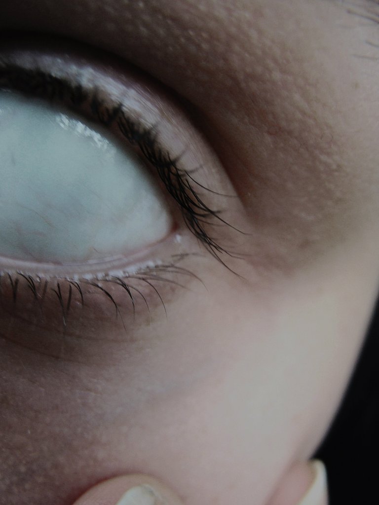 insomniac