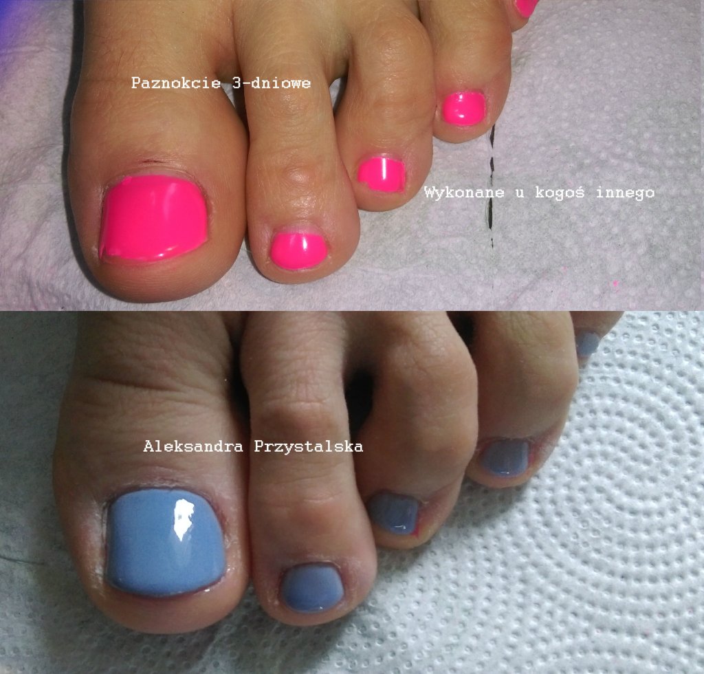 Pedicure