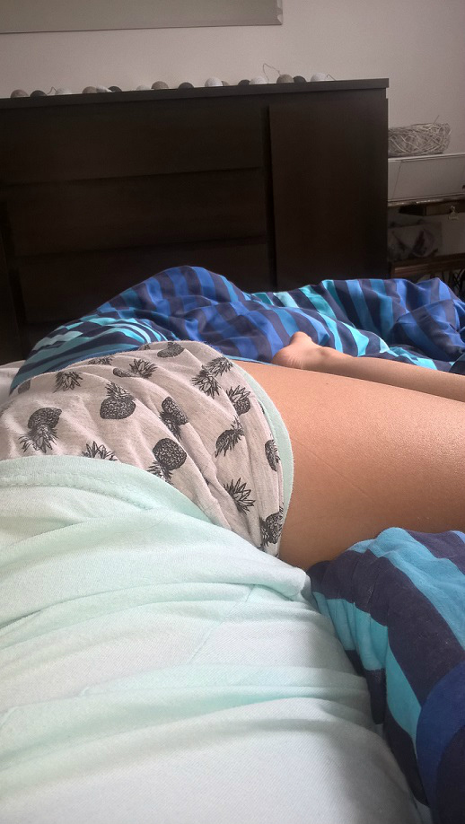 Ospa