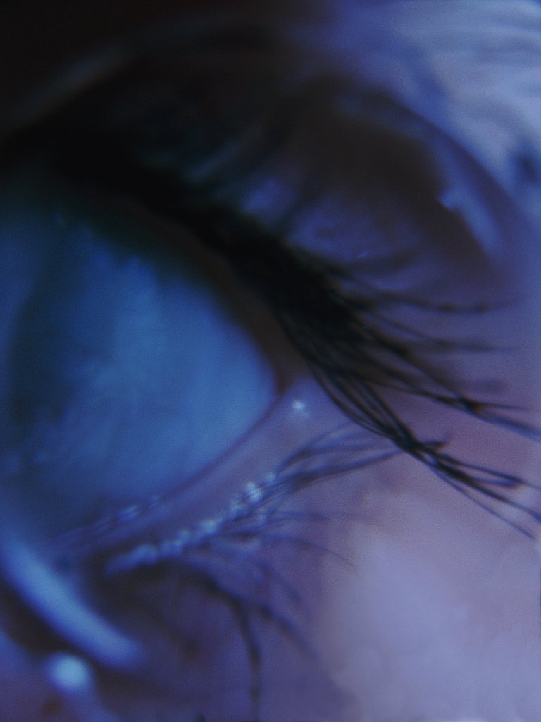 xixx