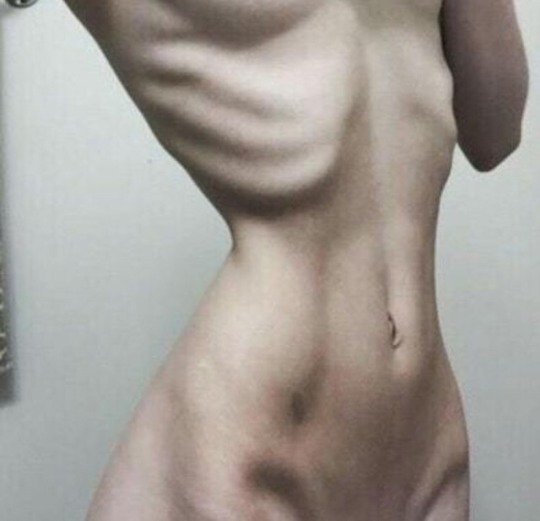 142.