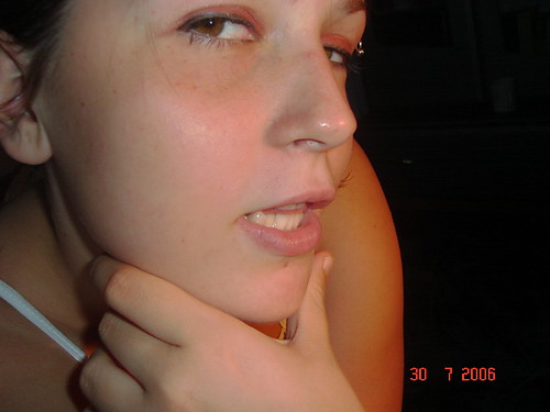 Wpis toksyna1