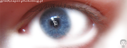 My eye!
