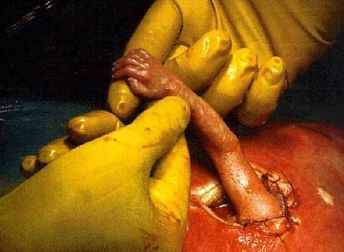 Hand of hope