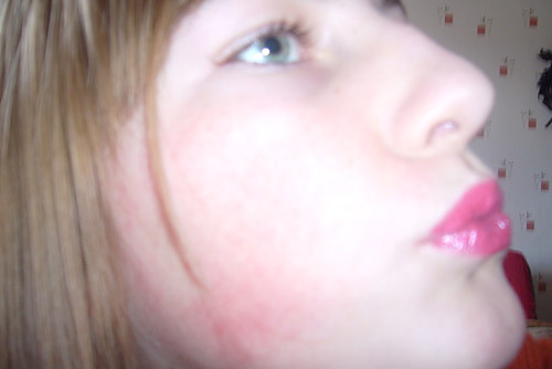 Buziak:*