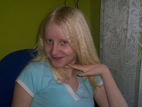 oMGGGXdd