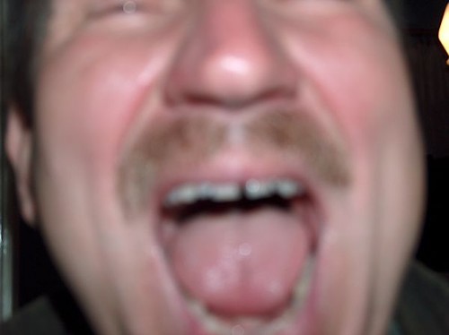 paszcza:D