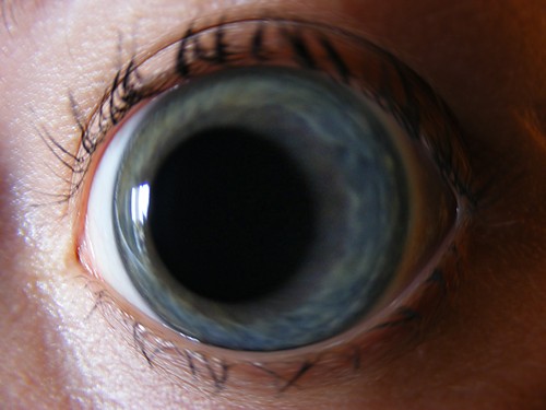 Fish Eye