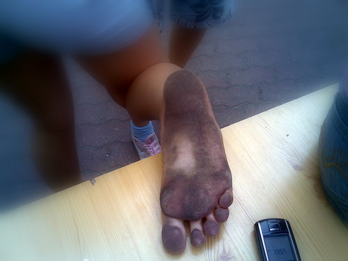 Stopka :P