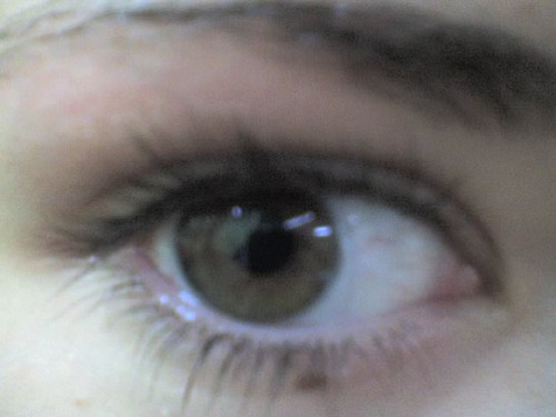 my eye