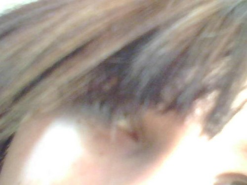 Chora :/