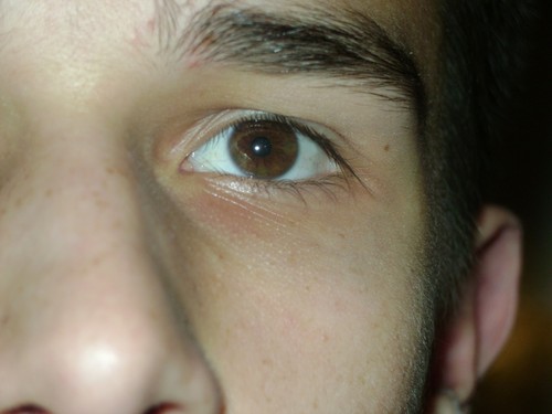My eye...