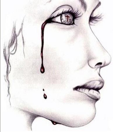 x]