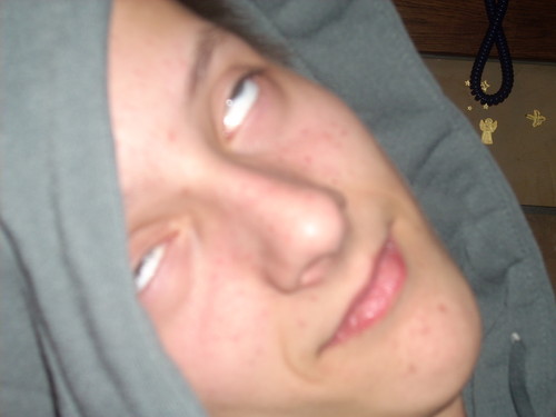 no i jak zwykle
