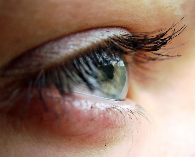 Eye