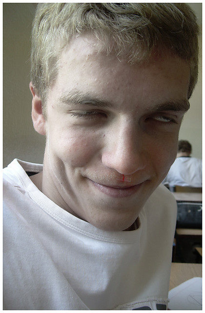 Wpis 8eloelde