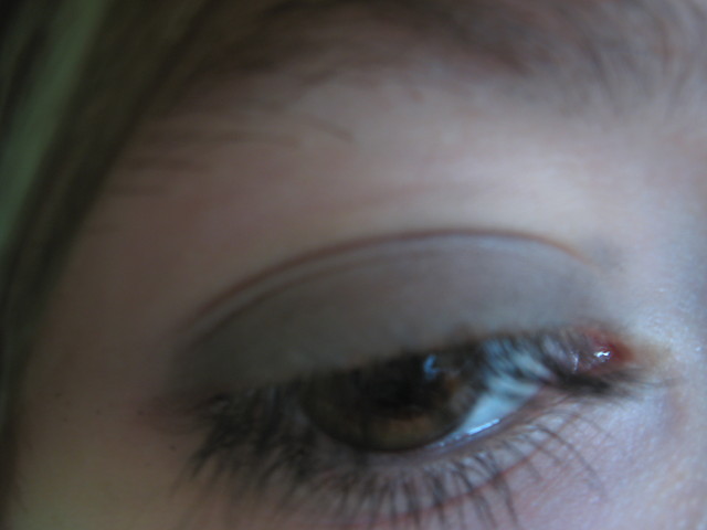 My eye.!