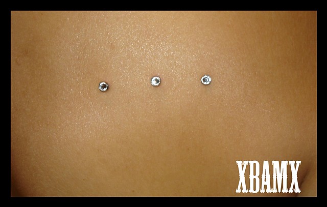 microdermal