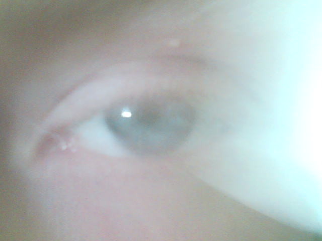 The Eye