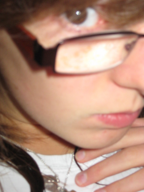 eye.