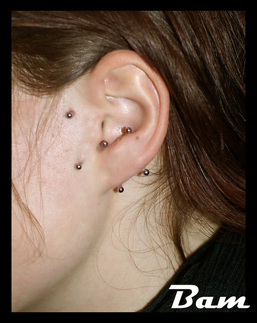 double vertical earlobe